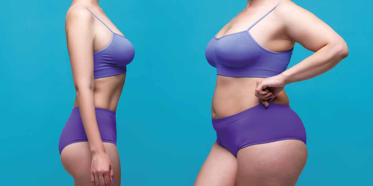 does iehp cover weight loss surgery