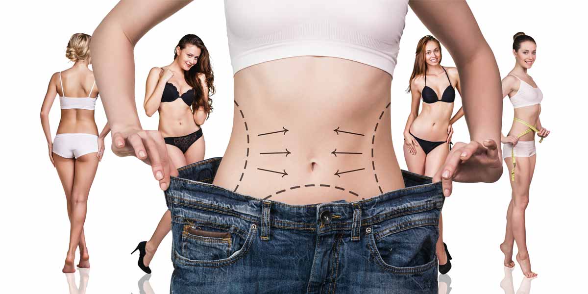 sleeve weight loss surgery cost