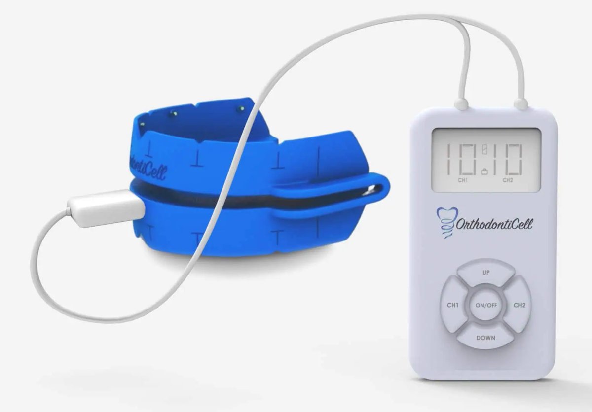 OrthodontiCell TM Bioelectric Protein Expression System for Accelerating Teeth Straightening
