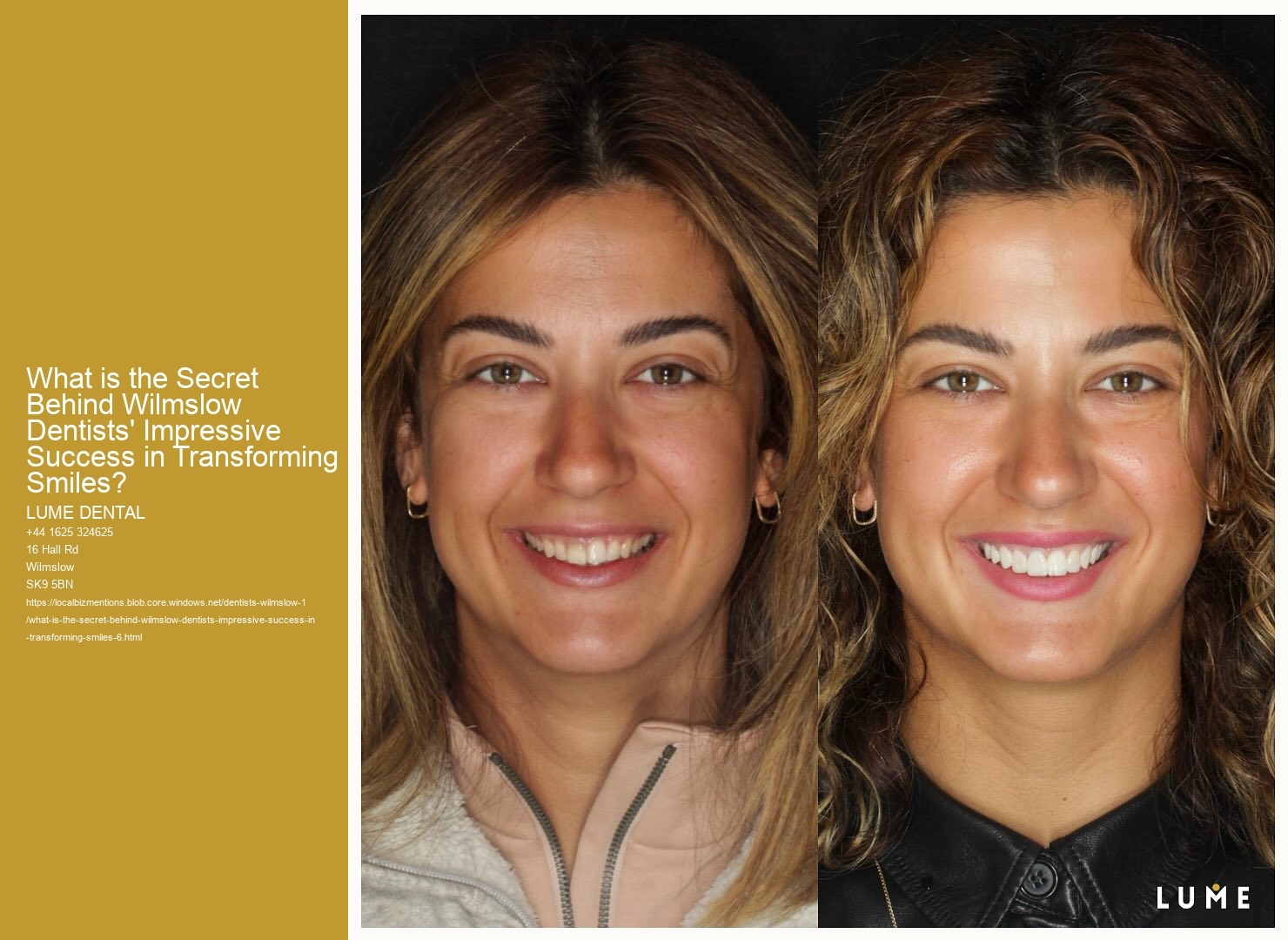 What is the Secret Behind Wilmslow Dentists' Impressive Success in Transforming Smiles?