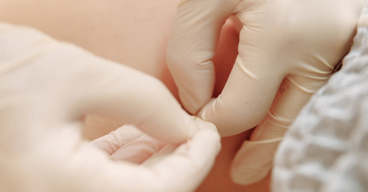 Dr Ashish Agrawal Physiotherapist