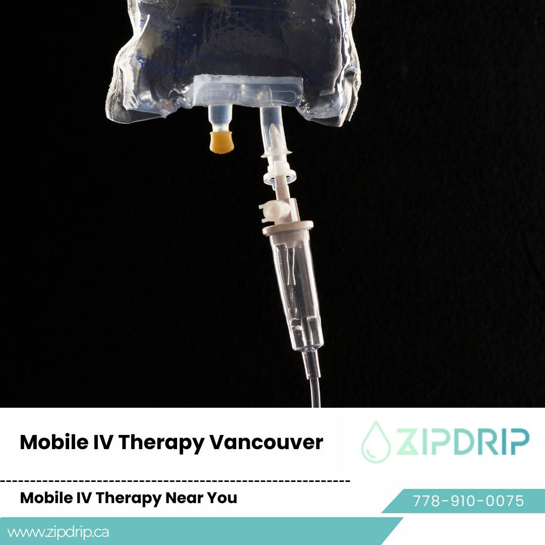 IV Infusion Therapy Vancouver Hangover Drip Service