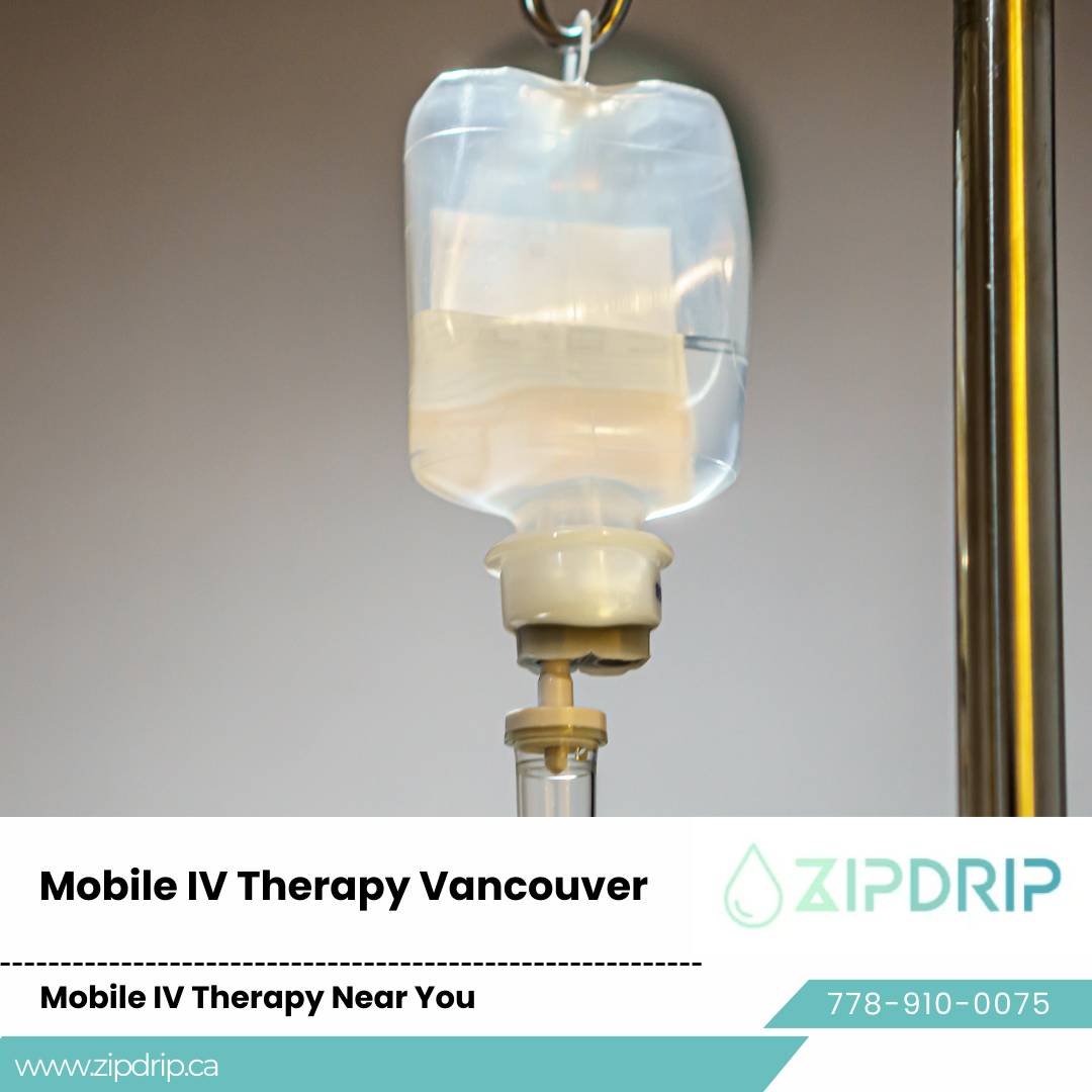 Vancouver Mobile IV Drip Service Mobile IV Therapy