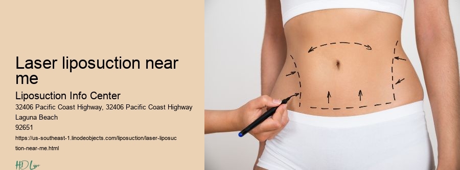 laser liposuction near me