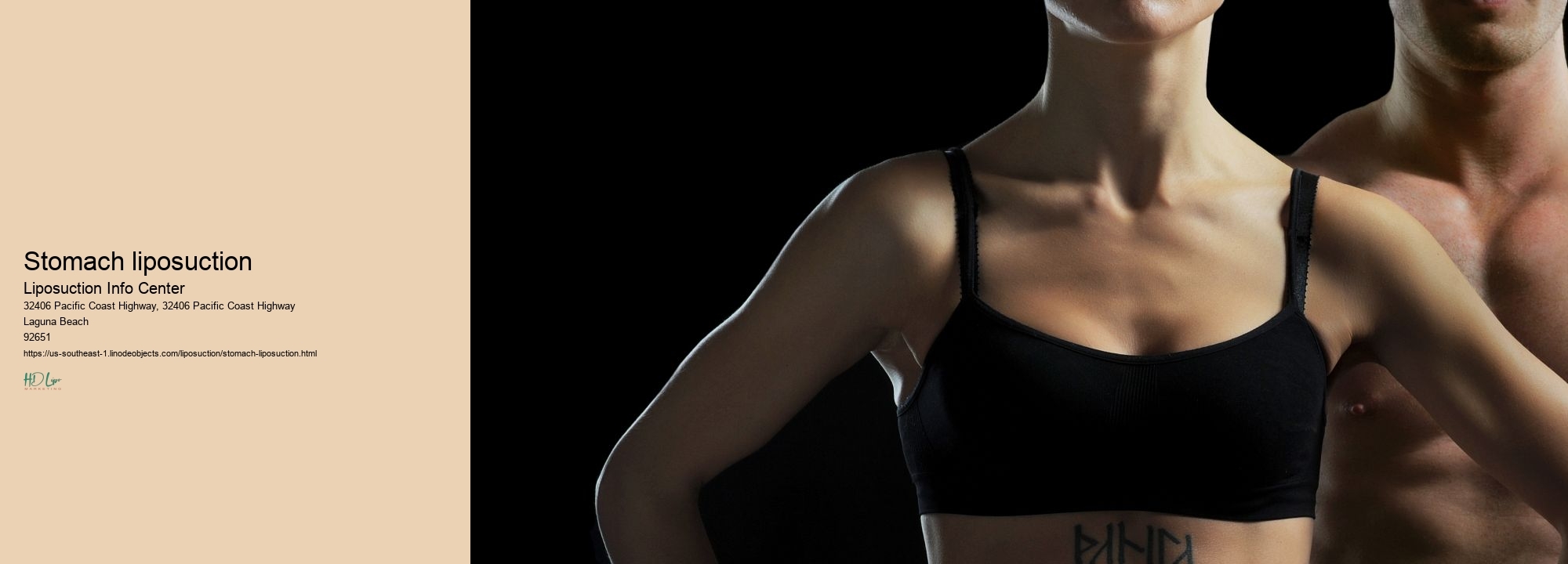stomach liposuction