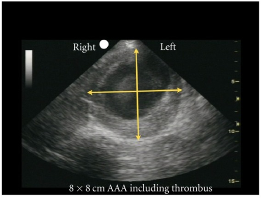 File:AAA.png