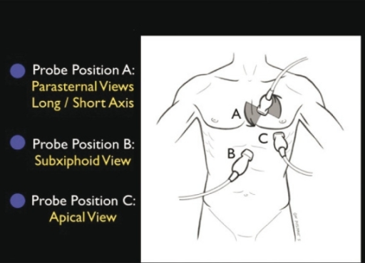 File:Cardiac Ultrasound.png