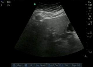 File:Duodenum.gif