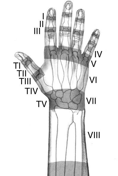 Extensor Zones.jpg