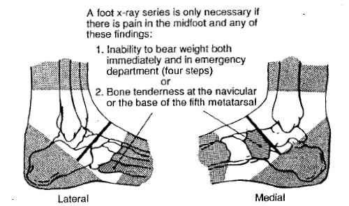 File:Footxray.jpg