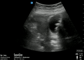 File:GBStone.gif