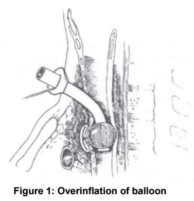 File:Hyperinflation-leveraging against innominate.jpg