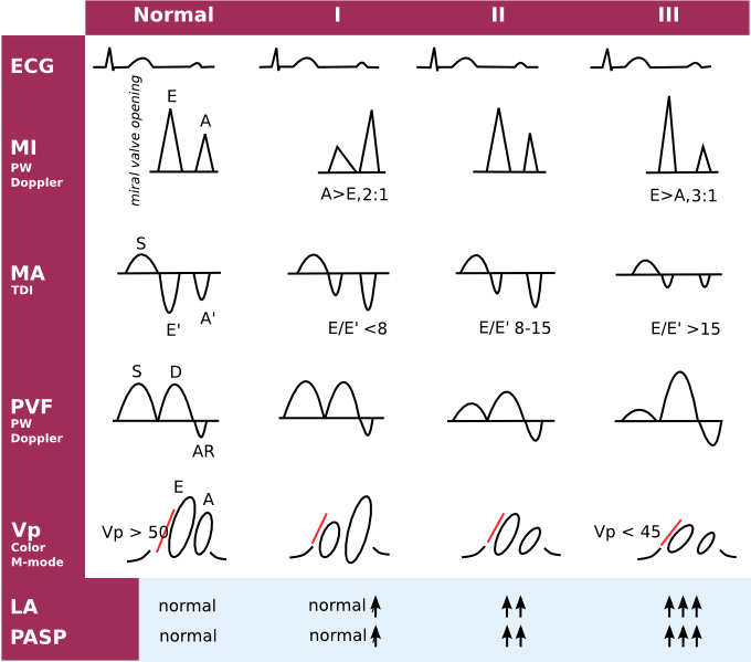 File:Large diastology chart.png