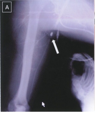 File:Leg.jpg