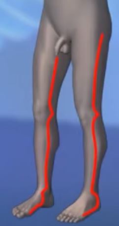 Lower extremities.JPG