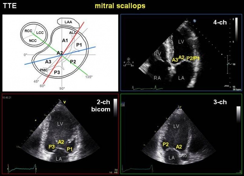 File:MV anatomy Apical.jpg