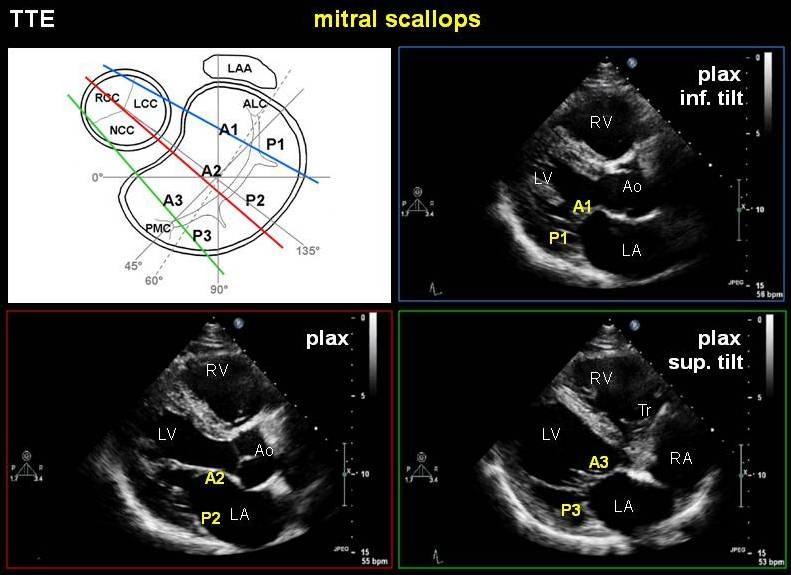 File:MV anatomy PSL.jpg