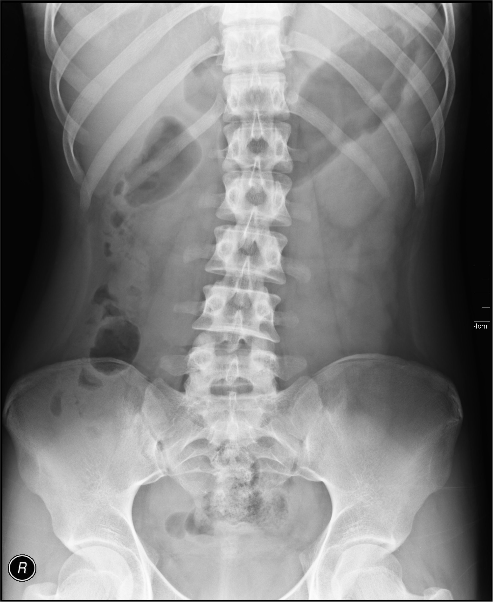 Medical X-Ray imaging ALP02 nevit.jpg