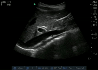 File:NormalGBSagittal.gif