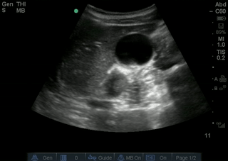 File:Normal GB in Tranverse.gif