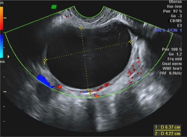 File:Simple cyst.jpg