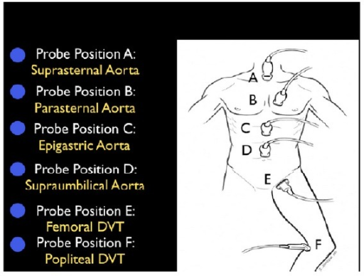 File:Step 3.png