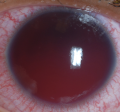 Thumbnail for version as of 17:53, 1 May 2026