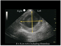 Thumbnail for version as of 19:51, 22 March 2015