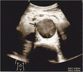 Thumbnail for version as of 18:11, 14 December 2015