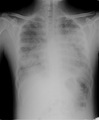 Thumbnail for version as of 11:40, 13 April 2016