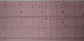 Thumbnail for version as of 04:07, 9 April 2015