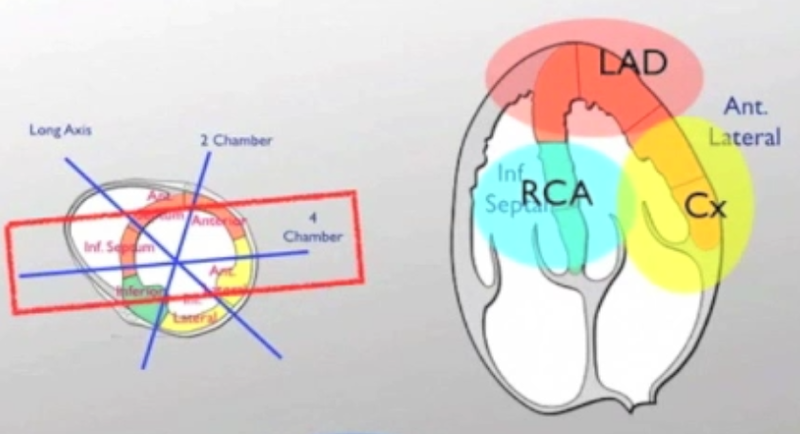 File:Apical Wall Motion.png