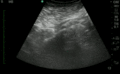 Thumbnail for version as of 17:26, 8 April 2016