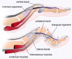 Boutonniere deformity.jpg