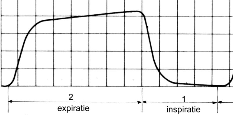 File:Capnogram.jpg