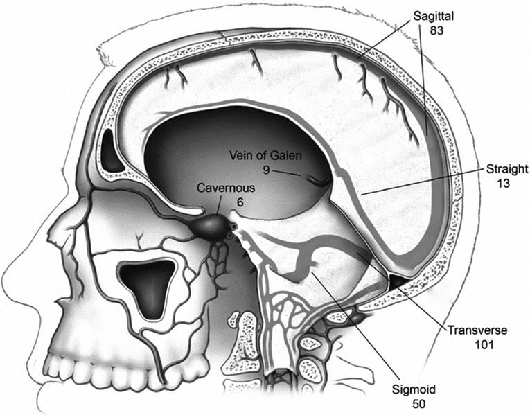 File:Cerebral veins.jpg