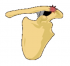 Classification type 1 of AC separation.png