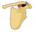Classification type 2 of AC separation.png