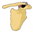 Classification type 4 of AC separation.png