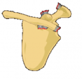Classification type 6 of AC separation.png