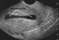 Thumbnail for version as of 21:34, 17 October 2017
