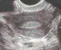 Thumbnail for version as of 20:46, 18 October 2017