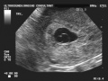 Thumbnail for version as of 19:28, 16 October 2017
