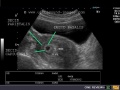 Thumbnail for version as of 02:55, 14 October 2017