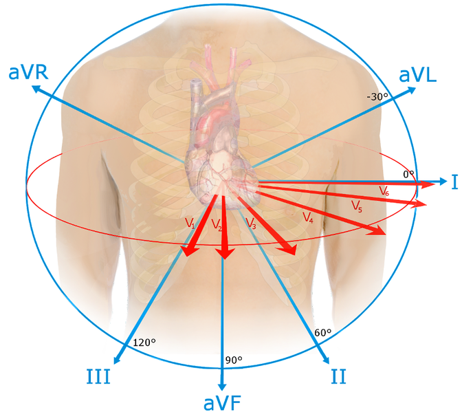 File:EKG leads.png