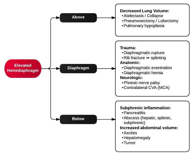 File:Elevated hemidiaphragm.png