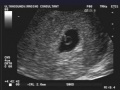 Thumbnail for version as of 19:35, 16 October 2017
