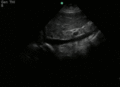 Flat IVC.gif