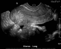 Thumbnail for version as of 21:17, 12 October 2017