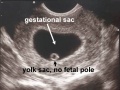 Thumbnail for version as of 20:10, 18 October 2017